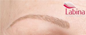 galerie_300x122_1__media__labina-haarausfall-alopecia-areata-nachher-zoom-permanent-make-up